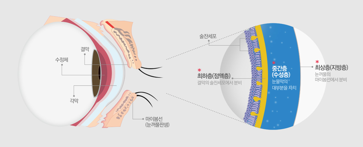 안구건조증 발생원인